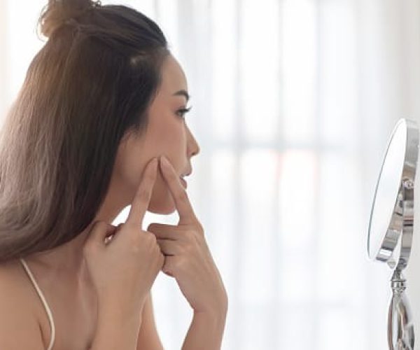 Como cuidar da pele com acne