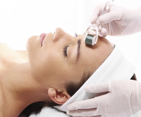 O que é o microagulhamento e seus benefícios