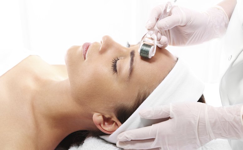 No momento, você está visualizando O que é o microagulhamento e seus benefícios