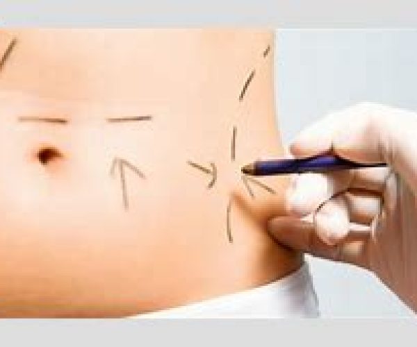 Qual melhor dia para iniciar a drenagem linfática pós operatório