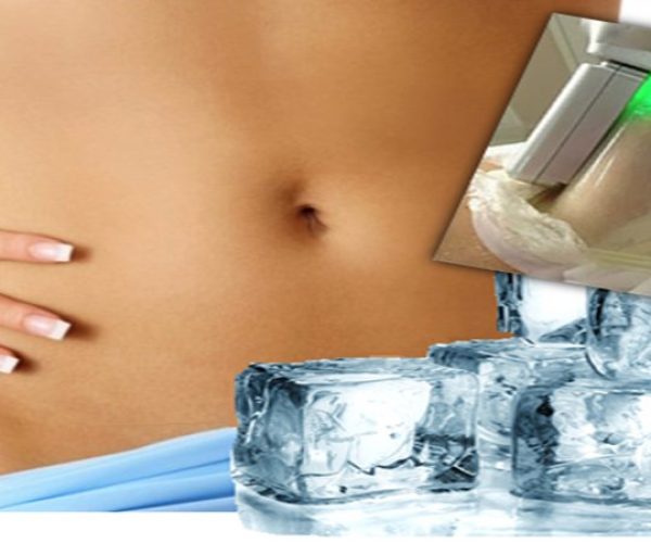 Como é o tratamento da criolipólise.