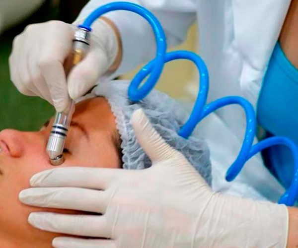 Posso fazer peeling no verão?