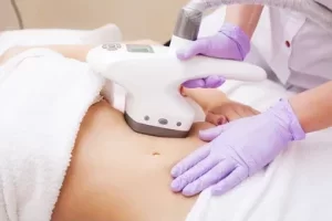 Leia mais sobre o artigo Benefícios da endermologia