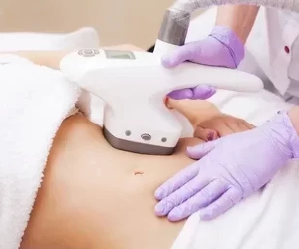 Benefícios da endermologia