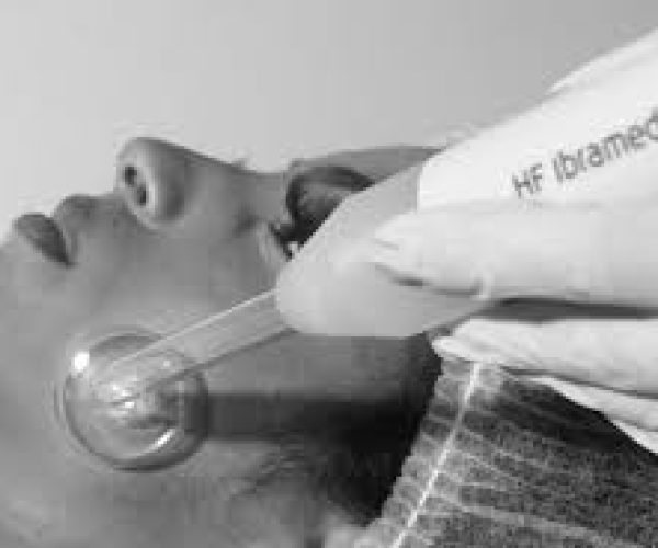 Benefícios do aparelho de alta frequência