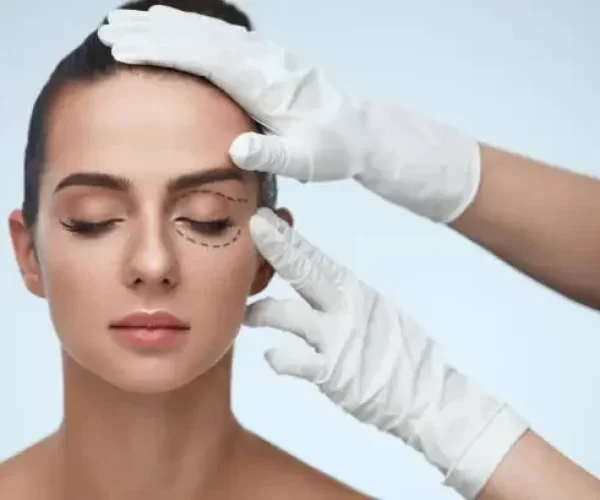 Cuidados no pós operatório de blefaroplastia