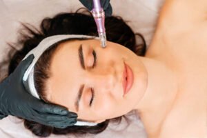 Leia mais sobre o artigo Quais os benefícios do Dermapen para pele?