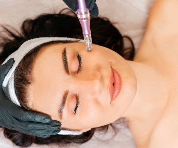 Quais os benefícios do Dermapen para pele?