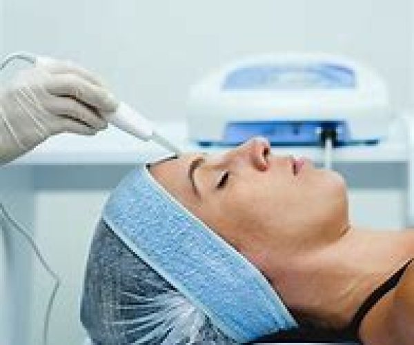 Benefícios do peeling ultrassônico