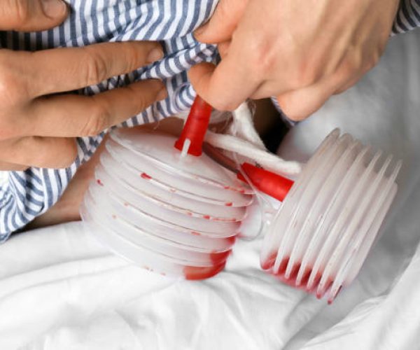 Benefícios do dreno no pós operatório de cirurgias estéticas