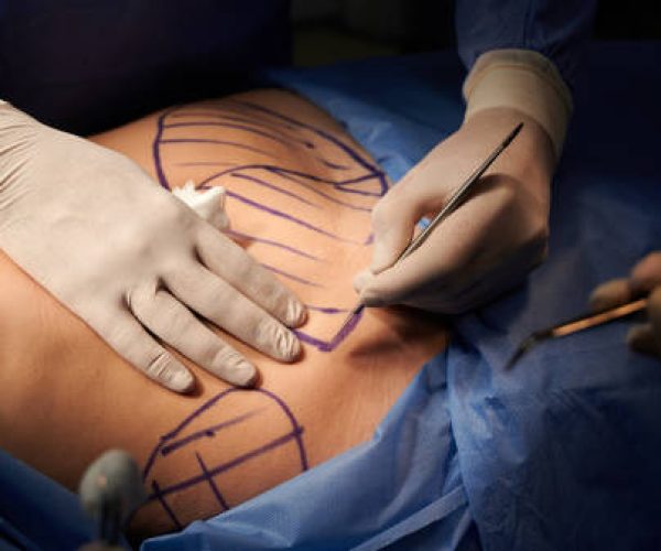 Benefícios da drenagem linfática no intraoperatório