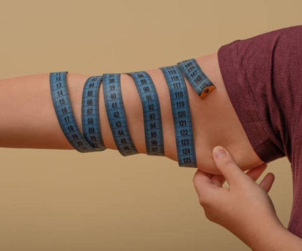 Como emagrecer sem ter flacidez?