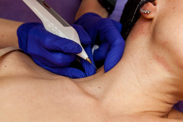 No momento, você está visualizando O que o endolifting e seus benefícios