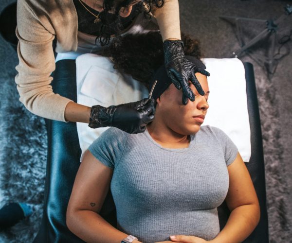 O que é o dermaplaning na estética