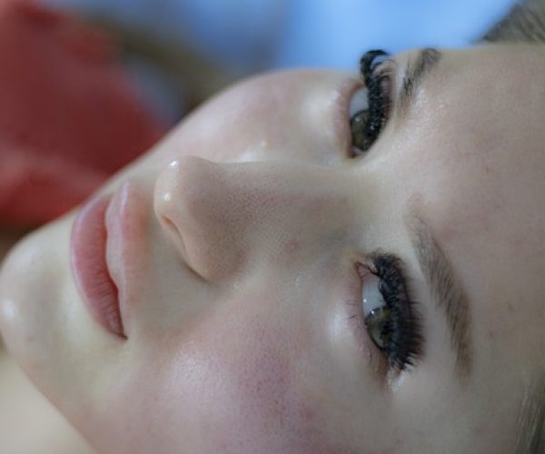 Jato de plasma e seus benefícios na pele