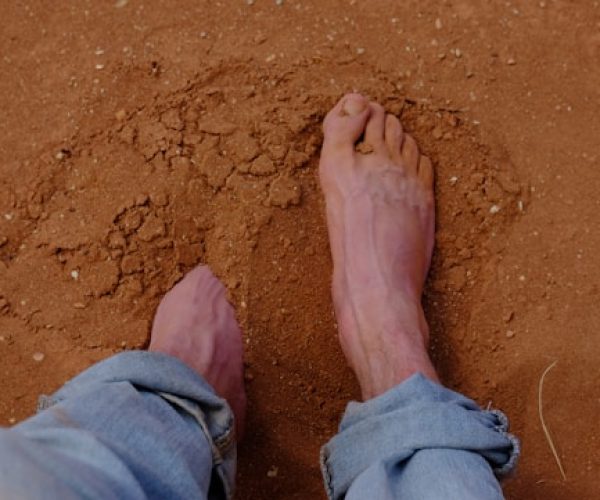 Como prevenir e tratar a joanete nos pés
