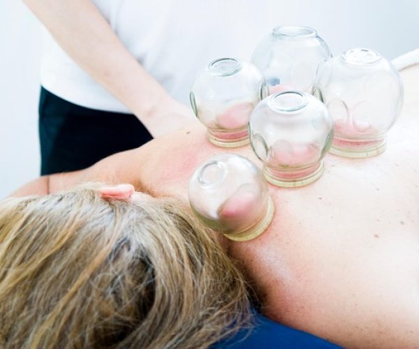 O que é a ventosaterapia e seus benefícios